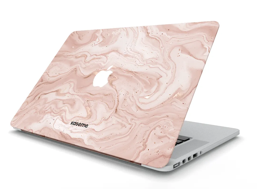 Midas Touch MacBook Skin vibrant color cover