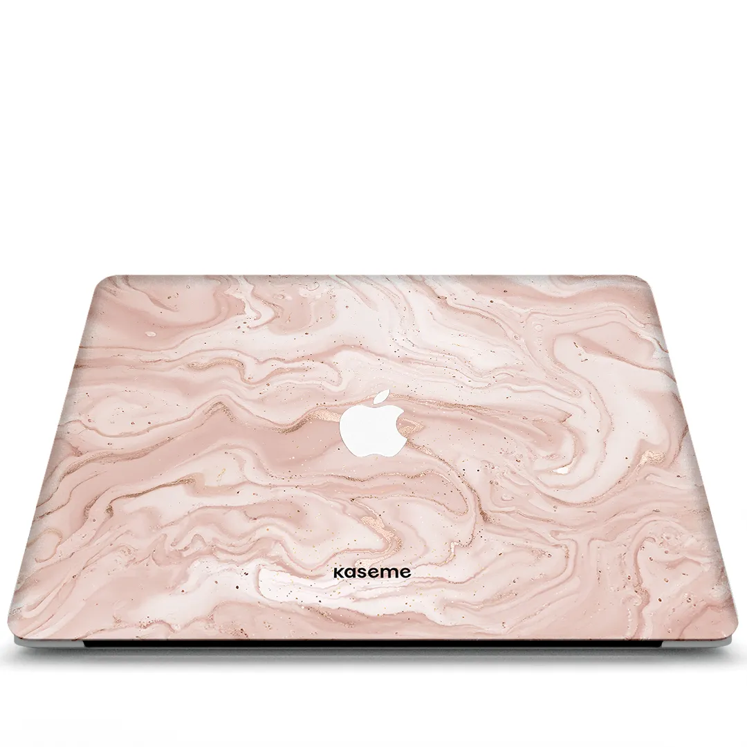 Tablet Sleeve Heavy Duty Armor Midas Touch MacBook Skin