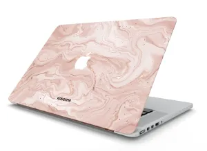 Midas Touch MacBook Skin vibrant color cover